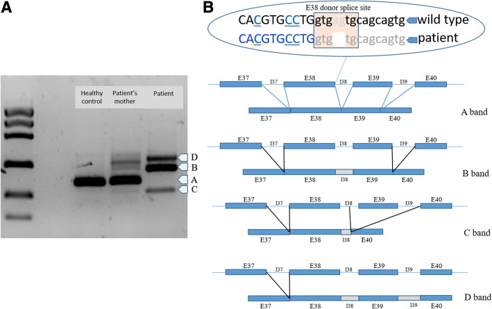 An external file that holds a picture, illustration, etc.
Object name is 12881_2019_844_Fig3_HTML.jpg