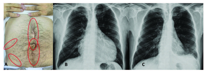 包含图片、插图等的外部文件。对象名称为 turkjmedsci-50-1591-fig001.jpg