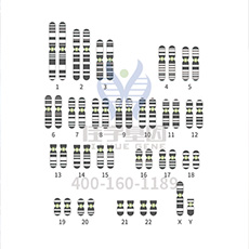 【佳学基因-基因检测】基因解码，发现结节硬化征（TSC）的致病基因