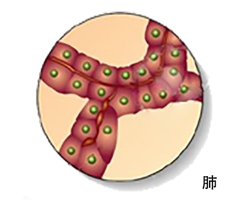 【佳学基因解码-基因检测】特发性肺动脉高压病基因解码基因检测