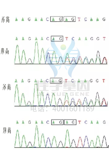 DYT7突变检测后采用什么药物治疗比较有效果？